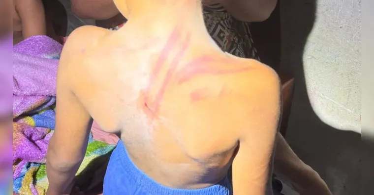 Foto: Guarda Municipal de Marituba